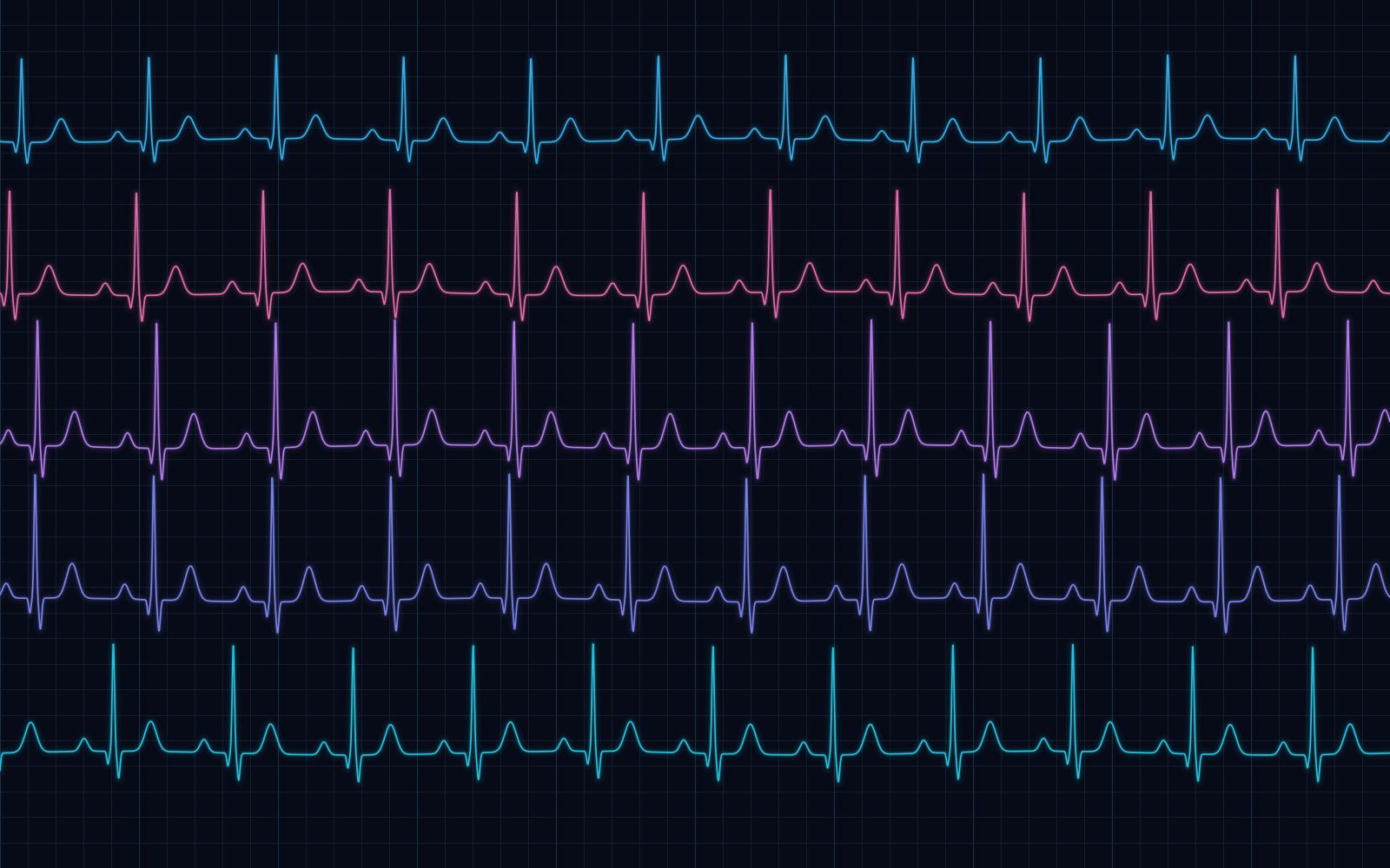 Multi-lead physiological signal traces